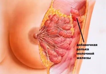 Добавочная доля молочной железы