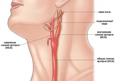 Исследование сосудов шеи и головы