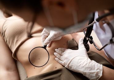 Удаление новообразований: вернем вашей коже гладкость и уверенность