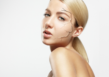 Обветривание кожи зимой: почему нужен дерматолог, а не только крем? Советы из Красноярска